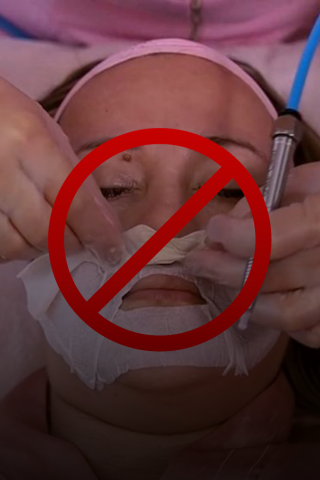 Substituições para algumas contraindicações de aparelhos